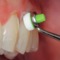 OptraSculpt Pad Kit